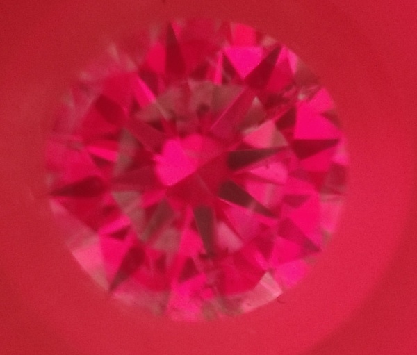 Imagen IdealScope