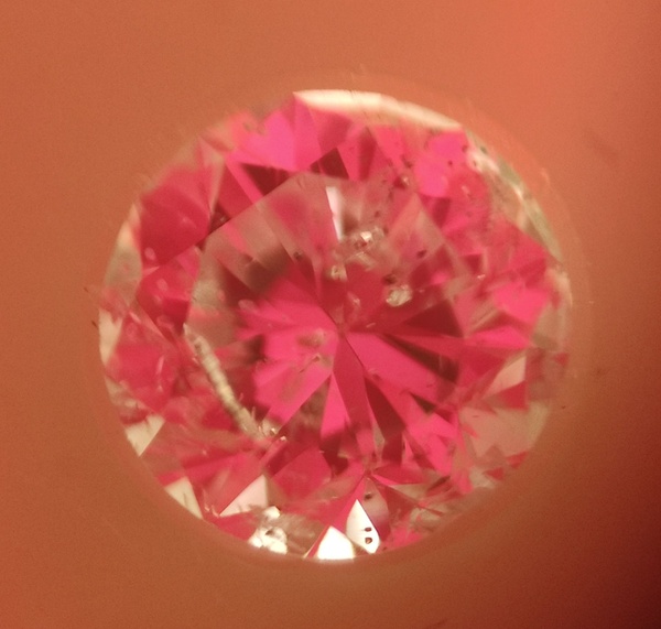 Imagen IdealScope